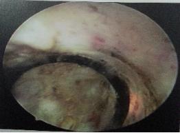 山东治疗泌尿外科比较好的医院,山东大学附属医院泌尿外科专家