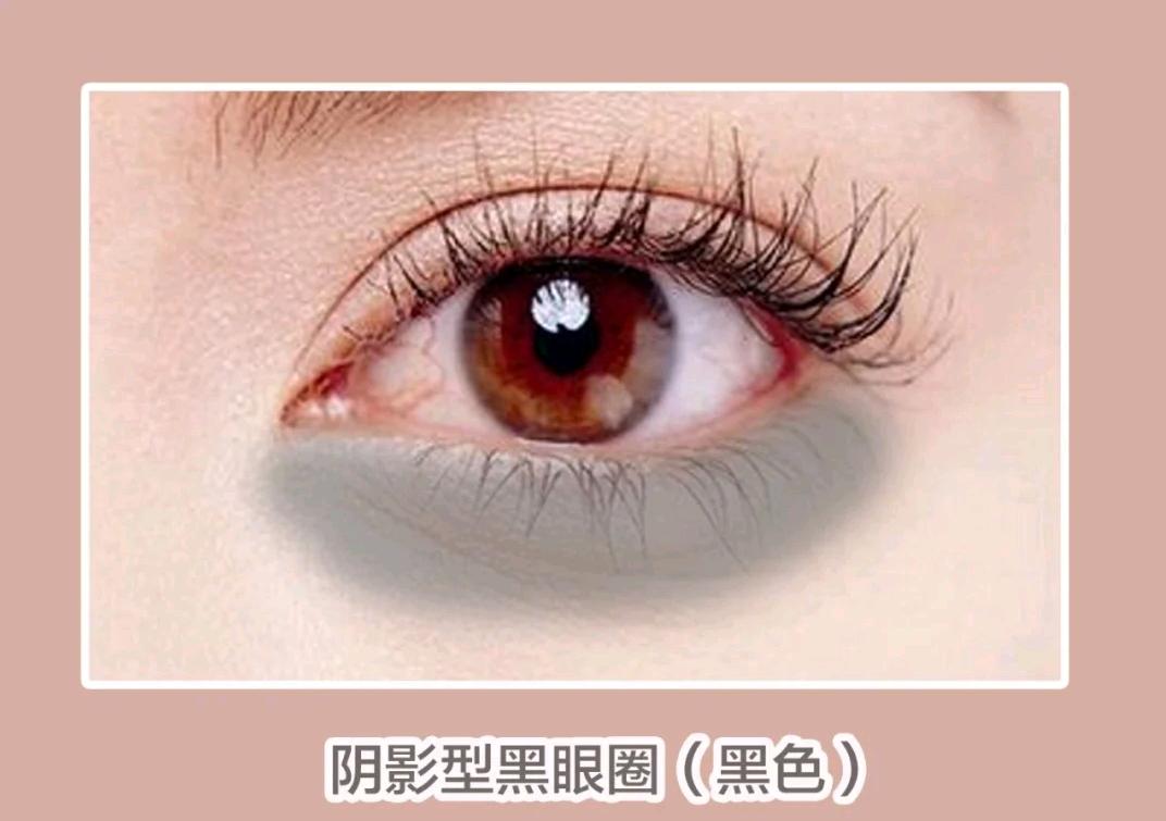 你的黑眼圈从哪来,你的黑眼圈是什么颜色