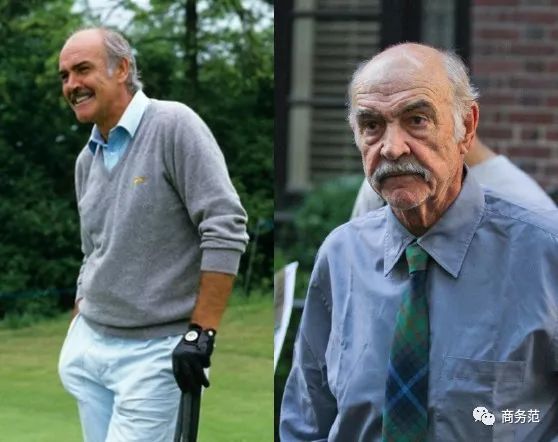 威廉王子秃顶了哈里为啥没秃顶,威廉王子为什么喜欢秃顶