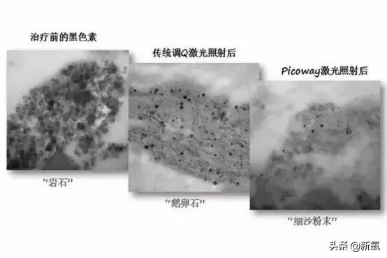 吴昕素颜真的很漂亮吗,吴昕为什么这么频繁上热搜