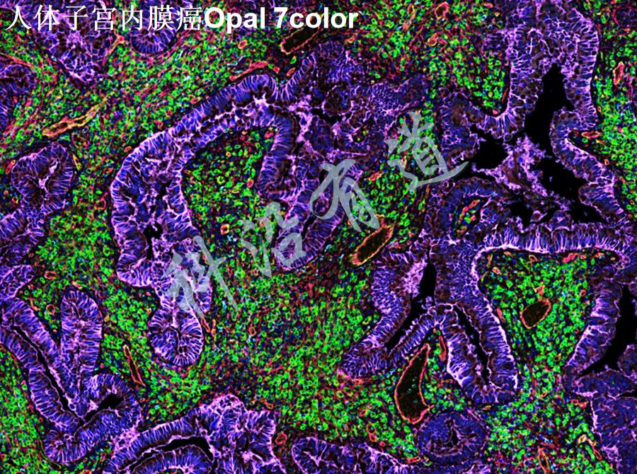 多色免疫荧光用什么设备看,多重荧光免疫组化原理