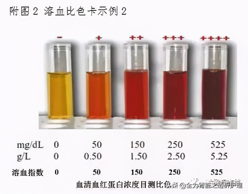 如何判断透析管路溶血,透析溶血率高的原因
