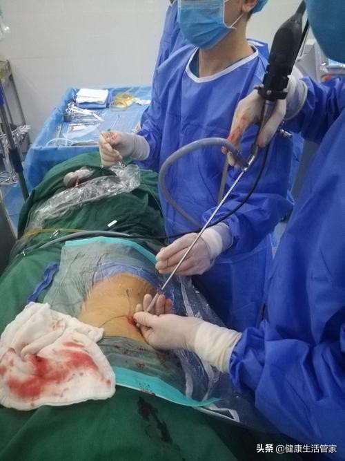 怎么断定得了尿路结石,得了尿道结石什么症状