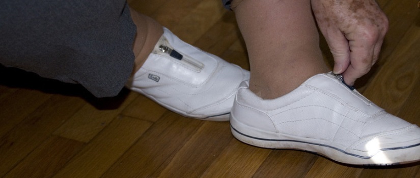 老年斑消除最好的方法男性,老年斑消除最快最有效方法