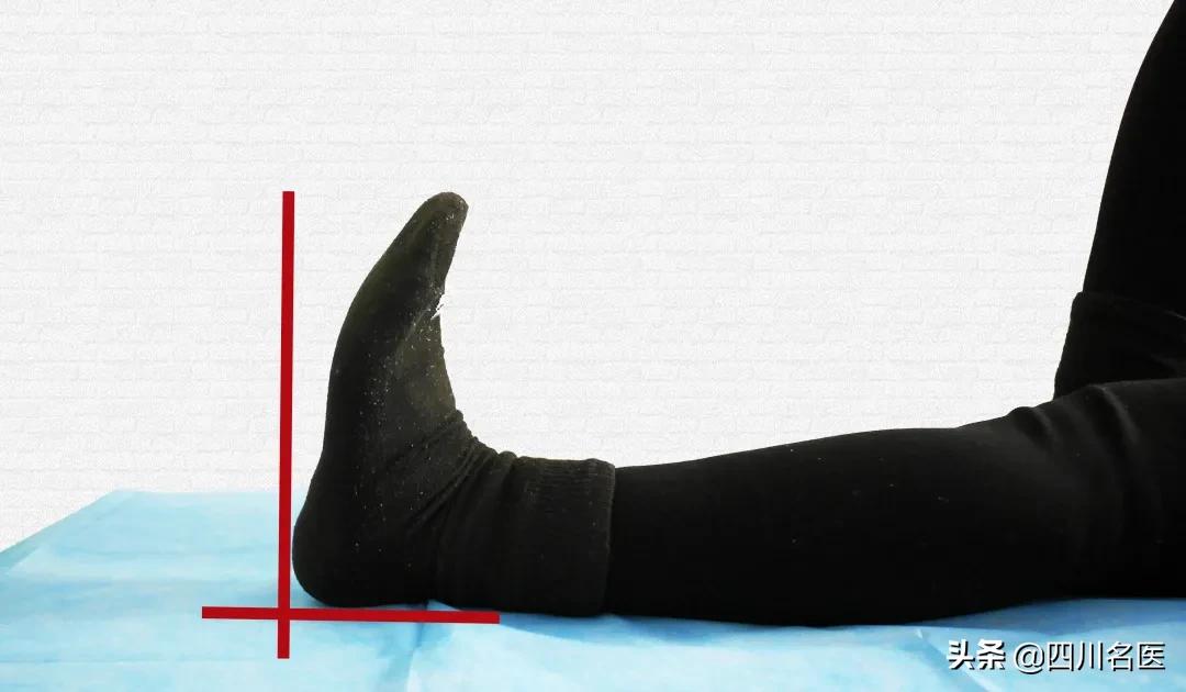 走路扁平足是什么原因,走路脚掌痛是大病前兆