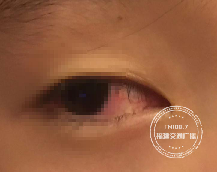 请一定远离木棉絮，福建各地都有，碰了后疼痒难忍，已经很多人中招