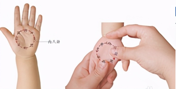 小儿腹泻的预防及用药禁忌,北京治小儿腹泻的中医