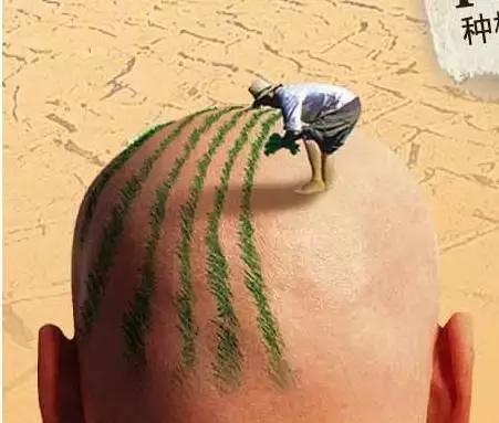 小孩喝完浑身长毛的这种“神药”，脱发的90后可否来一瓶？