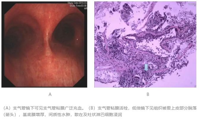工人用稀料清理泡沫10分钟即意识丧失，肝功能异常是否为切入点？