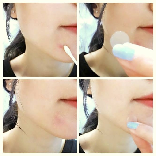 修丽可淡化痘印推荐,修丽可哪款祛黑痘印