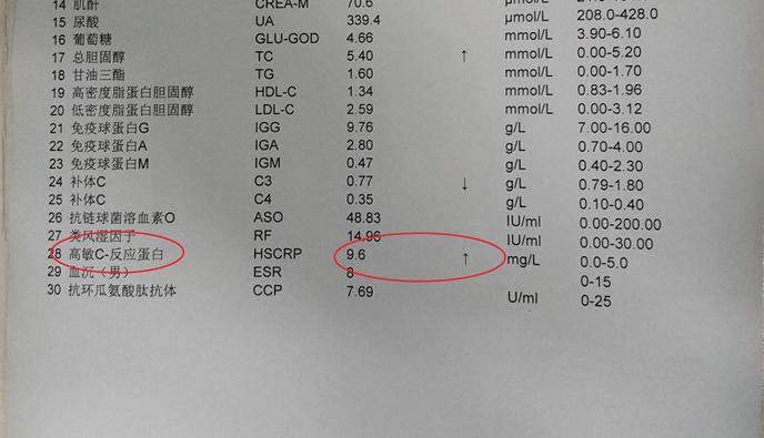 类风湿性关节炎抗风湿药能消肿吗,类风湿关节炎有哪些药是抗风湿的