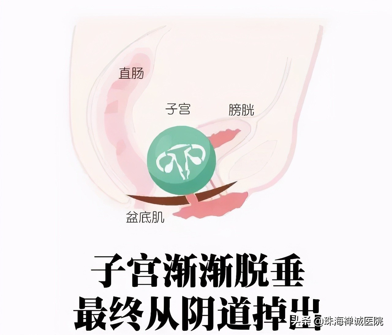 是否要做产后治疗,要不要做产后修复