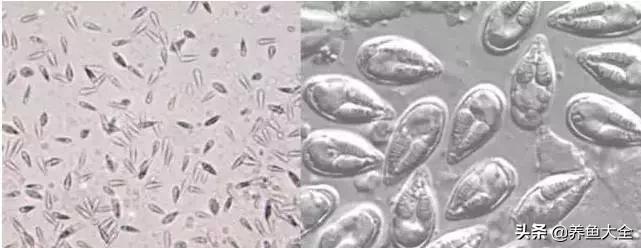 寄生虫多达6000条这种东西别乱吃,寄生虫的典型症状和表现
