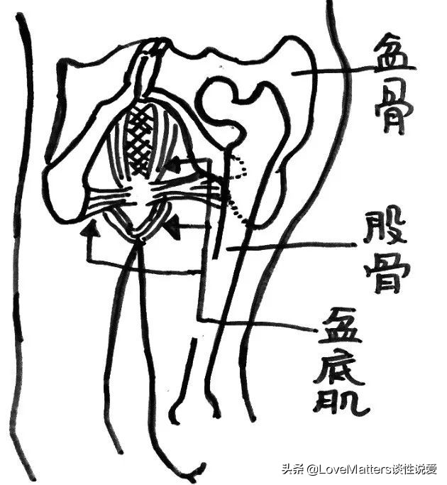 ella产后尿失禁案例,ella漏尿手术