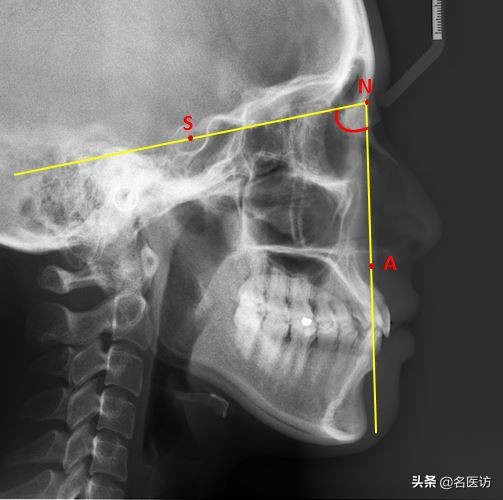 矫正牙科普馆,矫正牙齿科普知识
