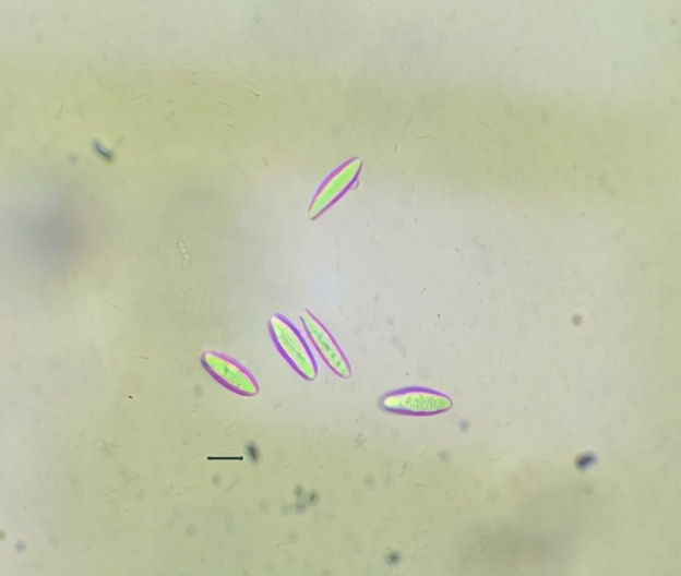 葡萄溃疡病的防治方法,葡萄溃疡病与白腐病有什么区别