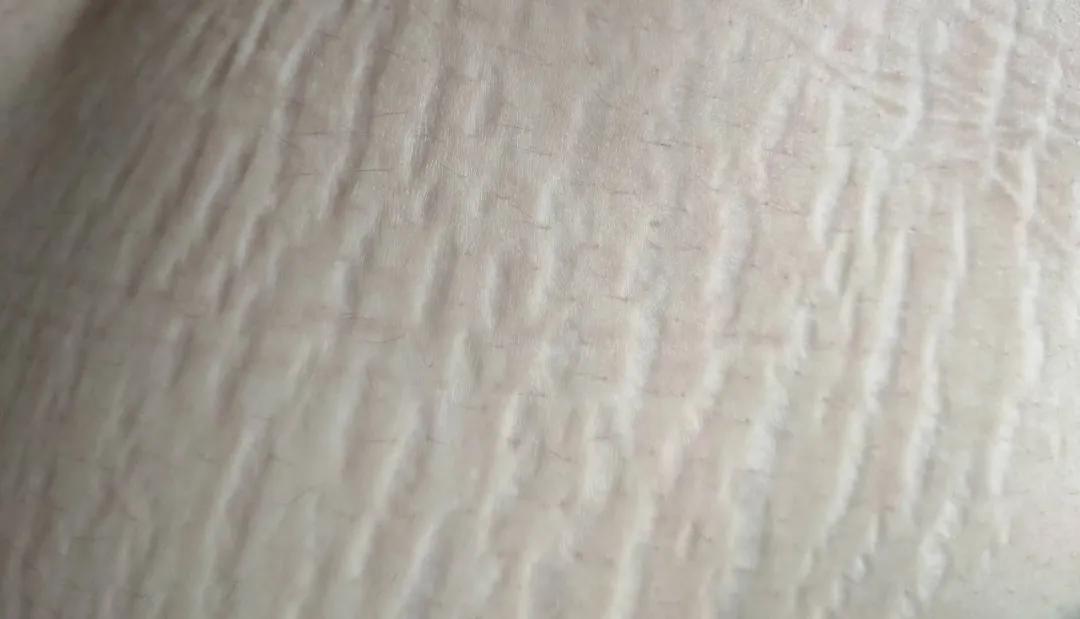 防妊娠纹霜什么时候用效果最好,防妊娠纹霜十大排名