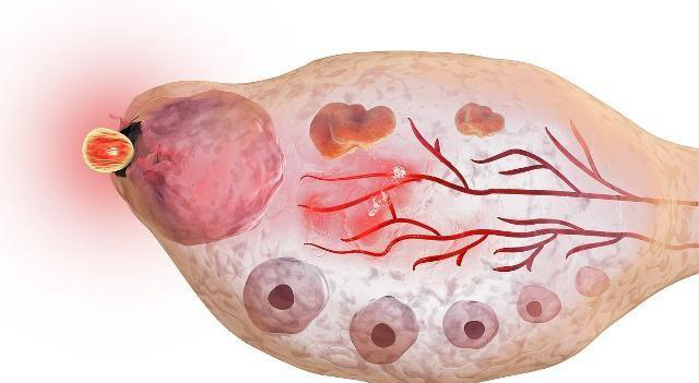 女性排卵时出现这3点要注意,女性在排卵有什么感觉