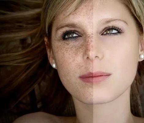 我们的黑眼圈与熬夜无关,黑眼圈和熬夜有关系吗