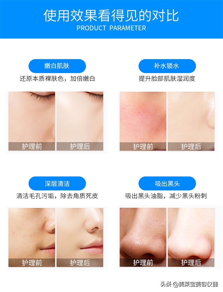 皮肤暗沉无光泽用什么护肤品,皮肤暗沉无光泽中医怎么调理