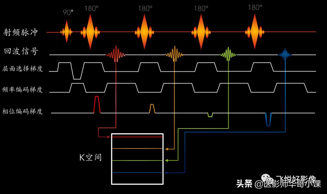 飞利浦磁共振序列参数解读,飞利浦磁共振快速扫描方案指南