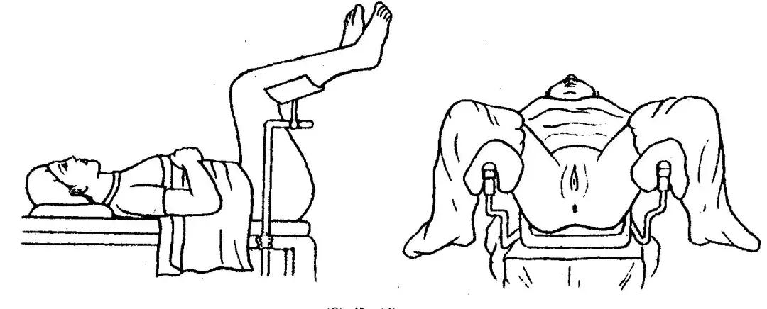 妇科检查你最怕哪个,妇科检查为什么会使月经提前