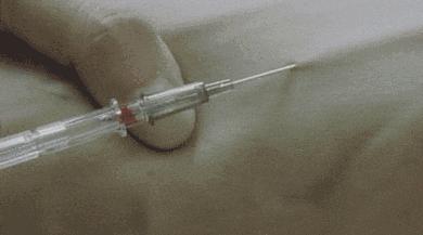 胳膊上的小圆疤是什么,每个人胳膊上的疤是怎么长出来的