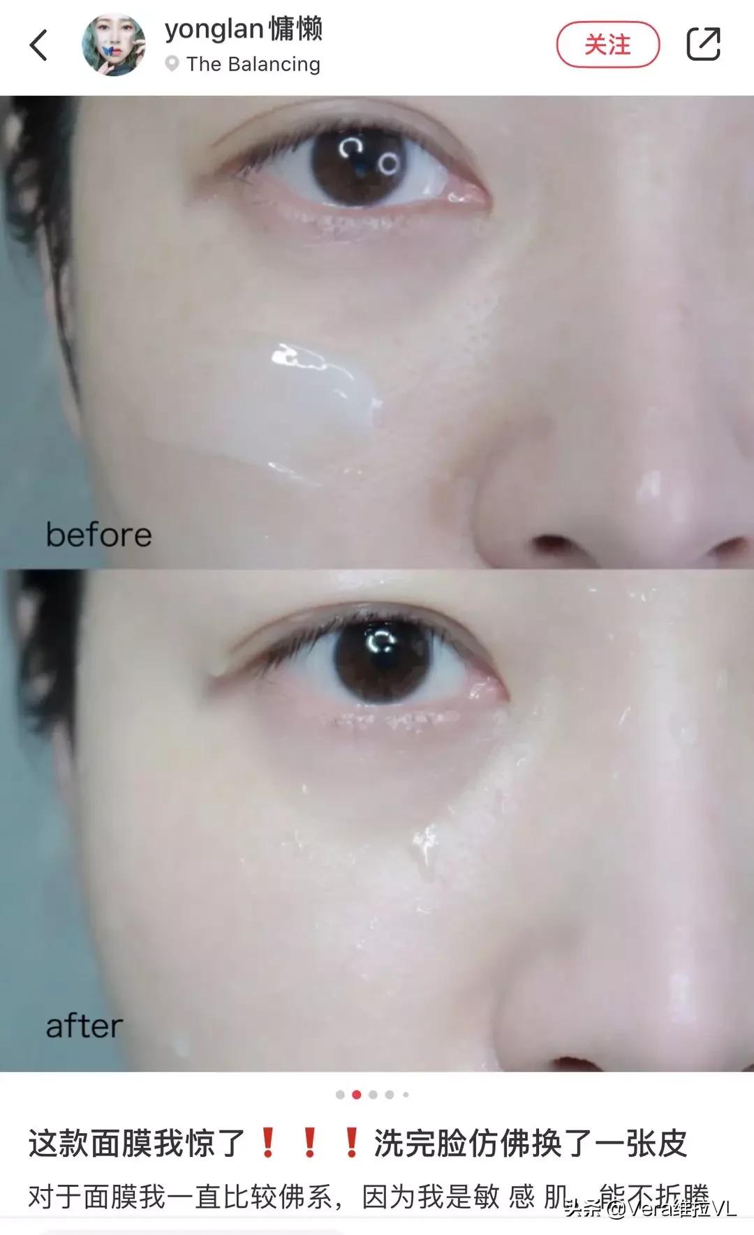 法国进口鱼子精华舒爽美肌面膜,法国珍贵鱼子精华奢润抗皱面膜