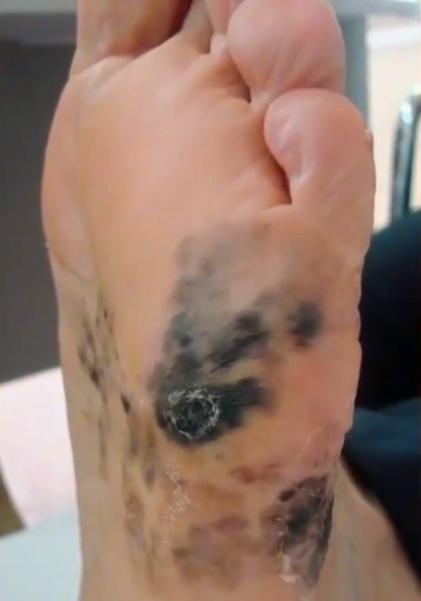 你身上的痣是什么,你身上的痣代表什么