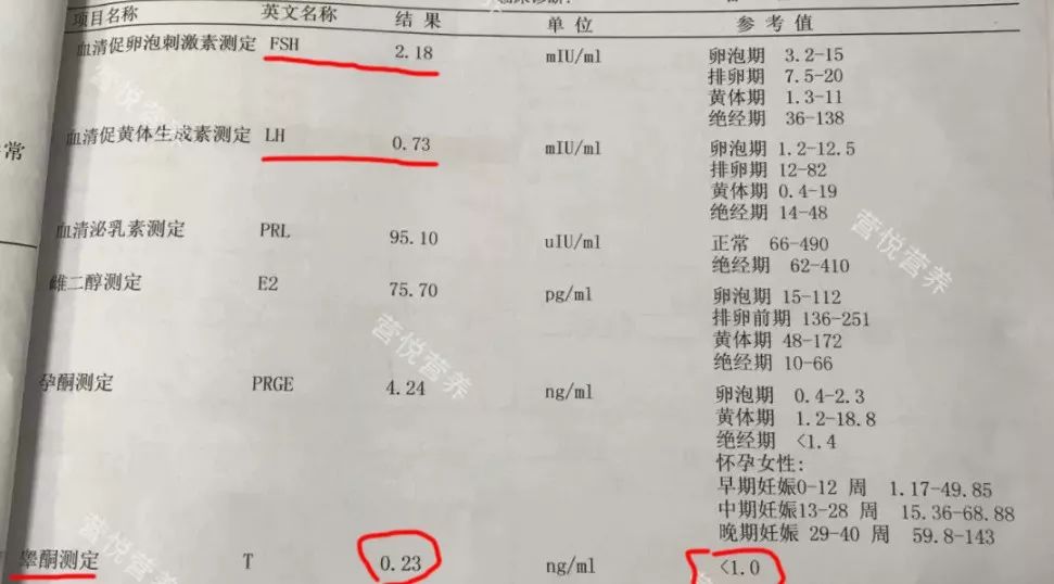 下丘脑功能性闭经鉴别诊断,下丘脑闭经和多囊闭经