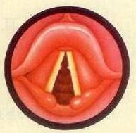 唱歌如何练好气息和打开喉咙,唱歌如何学会不用喉咙唱歌