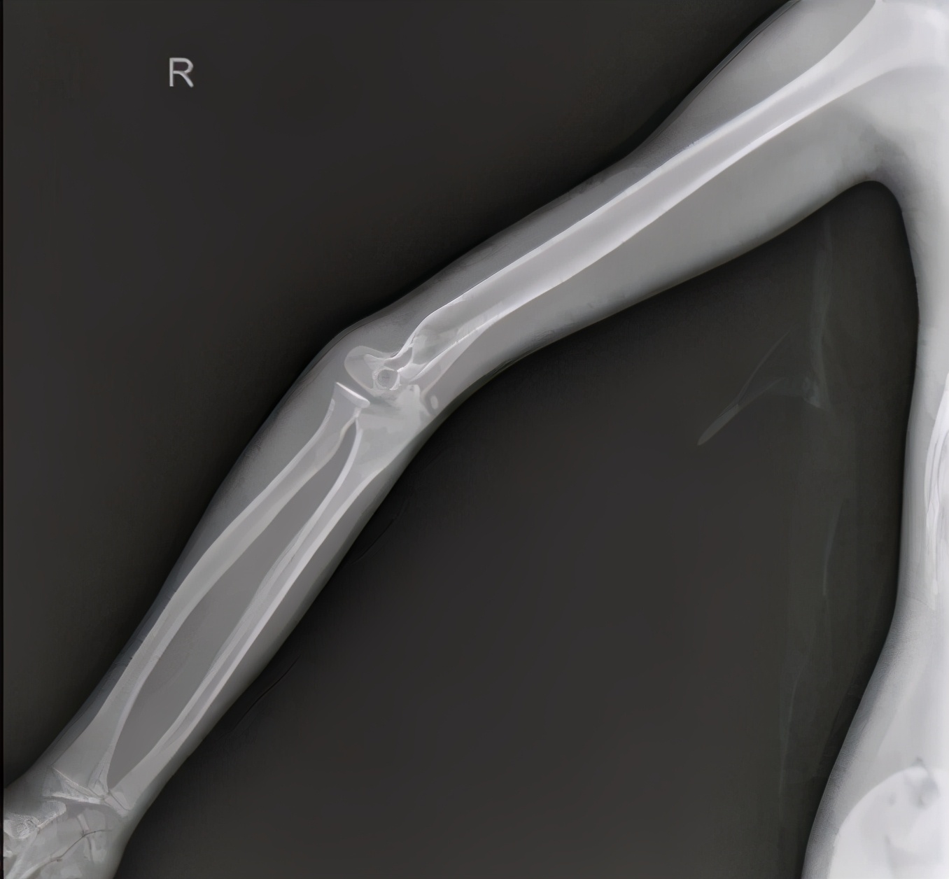 这个小伙子，胳膊肘真是往外拐的......