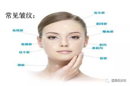 肉毒素怎么去皱原理是什么,肉毒素眼部祛皱多久打一次