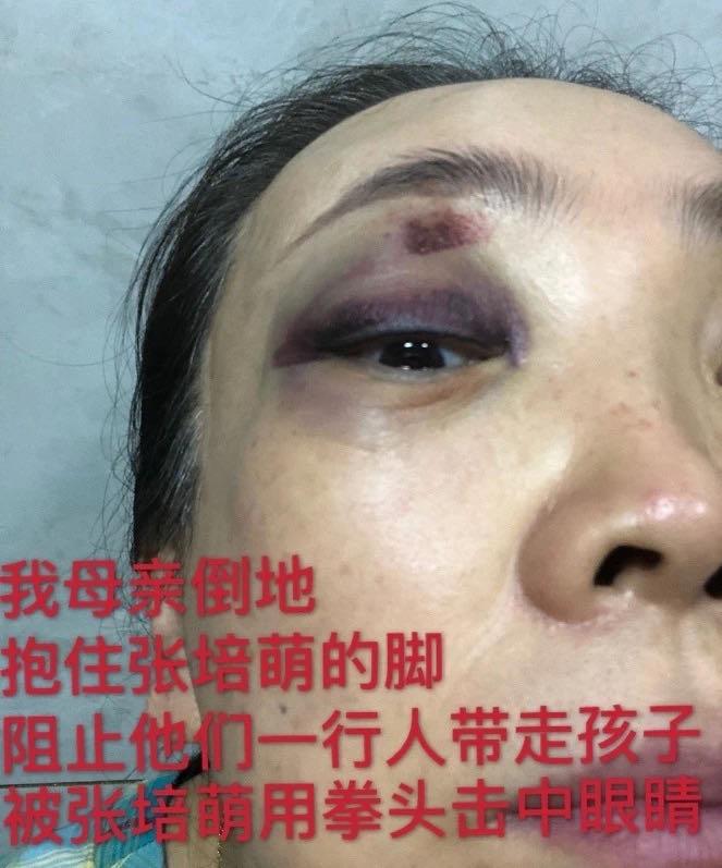 世界冠军家暴妻子,世界冠军女子拳击手被家暴