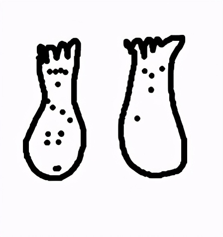 27岁男生脚臭,25岁帅哥脚臭怎么办