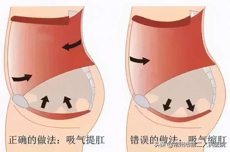 脱肛直肠坏死的早期症状,直肠脱垂有肉球脱出吗