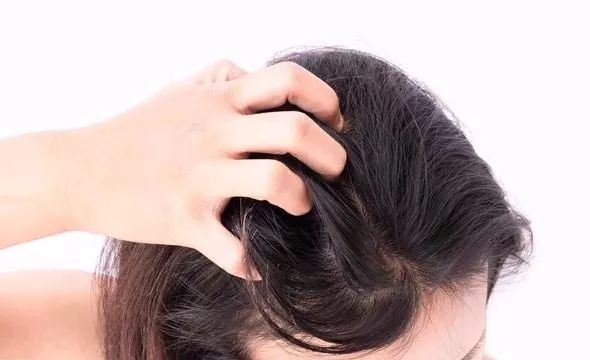 有头皮屑经常洗头还是减少洗头,不洗头没头皮屑一洗头就有头皮屑