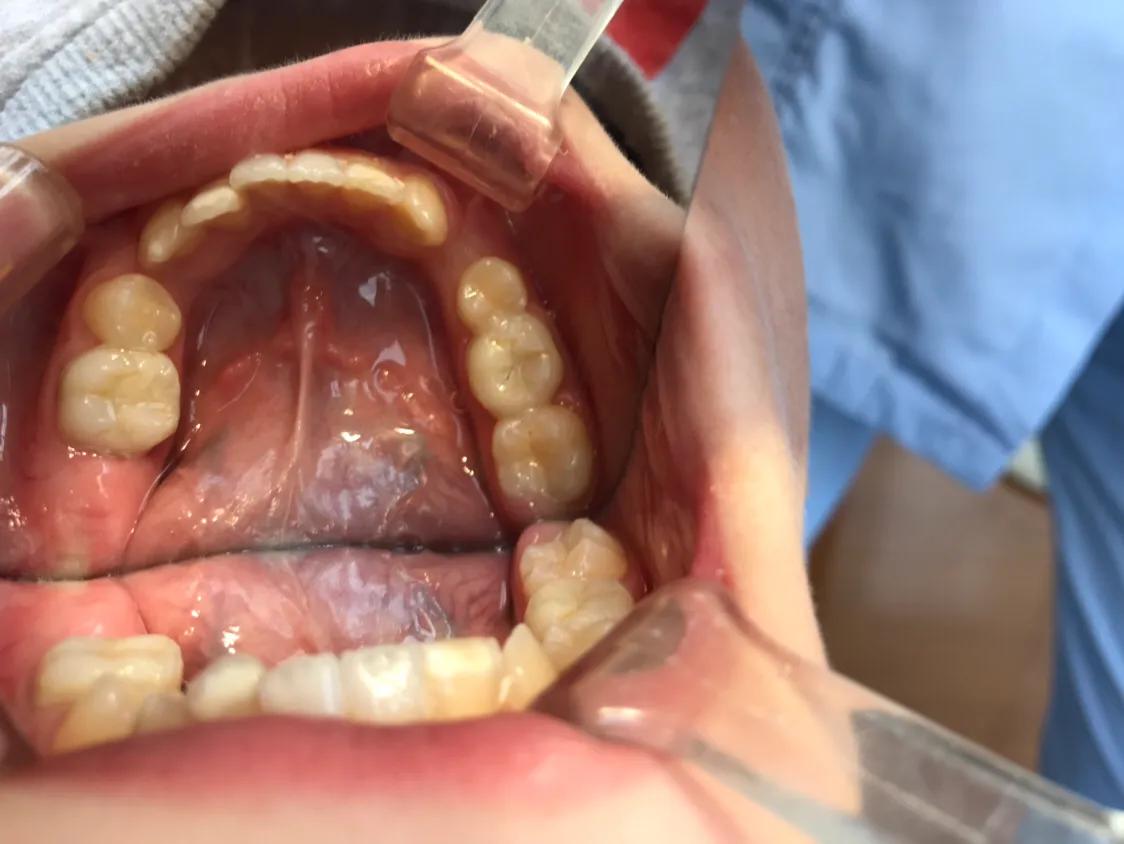 口腔垃圾怎么处理,口腔护理中的垃圾怎么分类处理