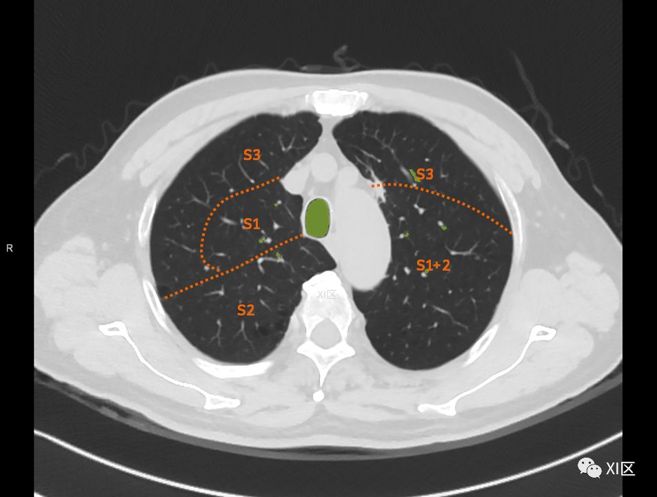 如此详细的肺部影像解剖，有点儿酷！