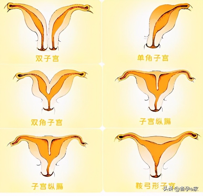 女性子宫的4大健康问题，绑架了你的婚姻和孩子