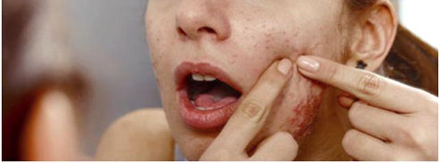 毛孔大皮肤粗糙怎么办,毛孔大皮肤变好