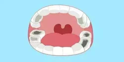 小孩少一颗牙最好的补救方法,孩子的牙有问题趁早看