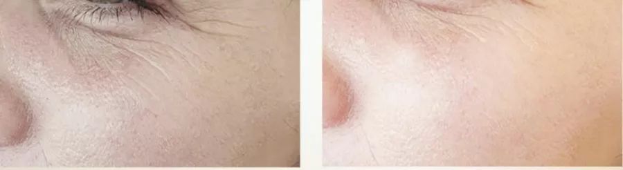 赵露思推荐补水保湿,赵露思推荐水感保湿焕颜面霜