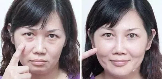 公认最好用的平价眼霜十大排行,最好用的十大平价眼霜排名