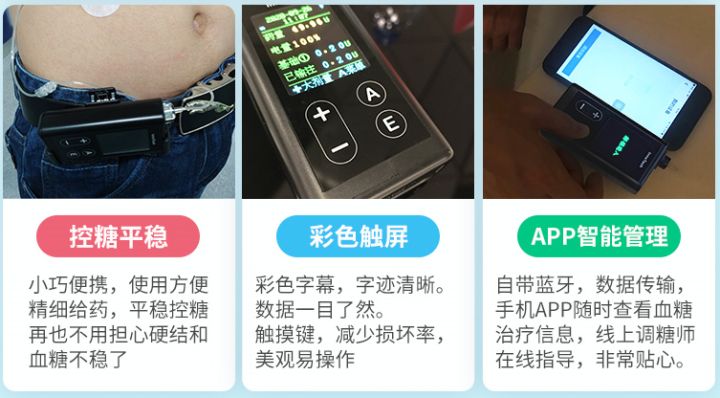 凯联乐胰岛素泵靠谱吗,进口的胰岛素泵有优惠吗