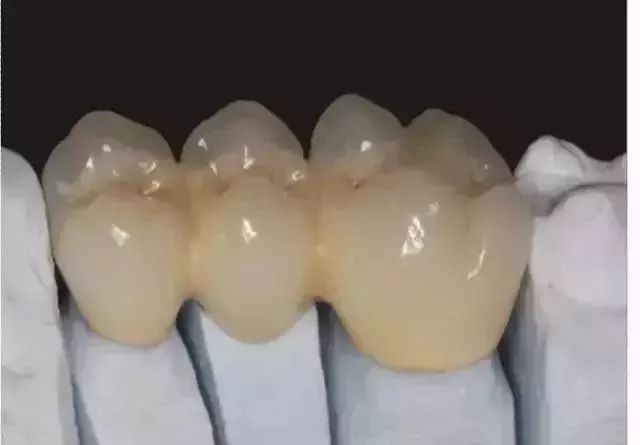 全瓷牙冠在保质期可以免费重做吗,全瓷牙冠价格表2021款报价