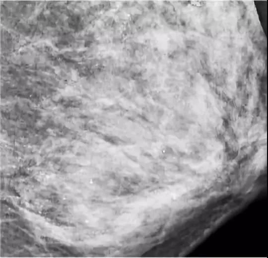 中国女人迷恋的乳房按摩，是一场彻头彻尾的*局骗**