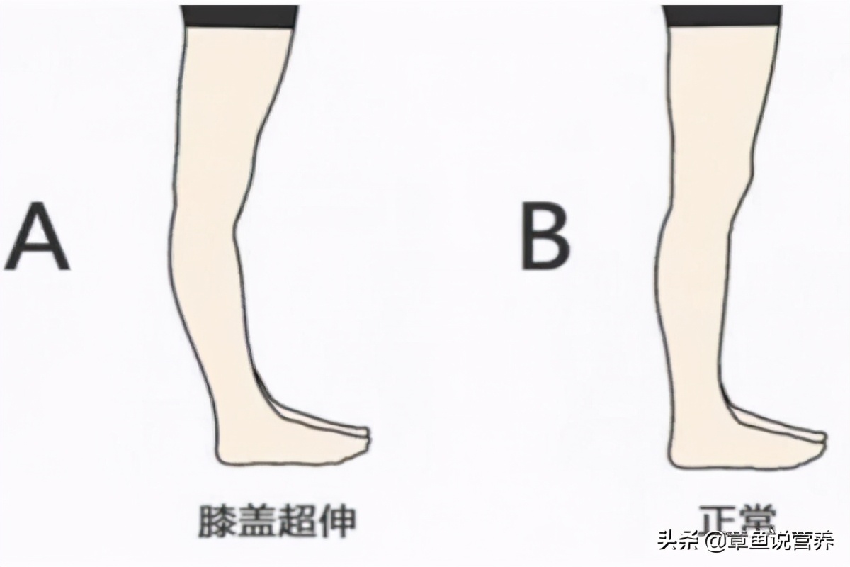 脑卒中的肢体康复训练,脑卒中步行训练的步骤及要点