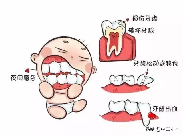 小孩睡觉磨牙有虫吃什么药,孩子睡觉磨牙什么原因吃啥打虫药
