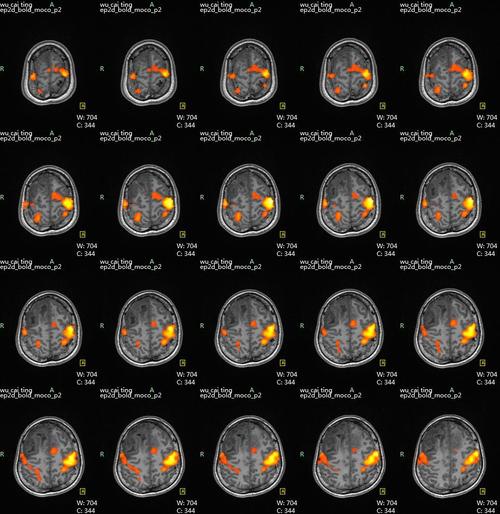 所谓同性恋“治疗”，不要对你不理解的事情充满敌意